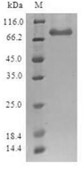 SDS-PAGE (SETDB1-2120H).jpg